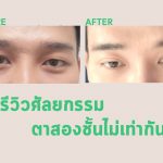 ตาสองชั้นไม่เท่ากัน